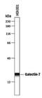 Galectin 7B antibody, PA5-47124, Invitrogen Antibodies, Western Blot image 