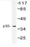 Cyclin Dependent Kinase 5 Regulatory Subunit 1 antibody, AP06734PU-N, Origene, Western Blot image 