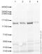 Neurofilament Medium antibody, ab64300, Abcam, Western Blot image 