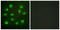 Estrogen Receptor 2 antibody, LS-C198936, Lifespan Biosciences, Immunofluorescence image 