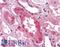 GM2 Ganglioside Activator antibody, LS-A8935, Lifespan Biosciences, Immunohistochemistry paraffin image 