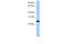 LOC344065 antibody, 30-689, ProSci, Western Blot image 