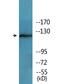 Protein Tyrosine Kinase 2 antibody, LS-C291572, Lifespan Biosciences, Western Blot image 