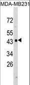 N-Myc Downstream Regulated 1 antibody, LS-C164789, Lifespan Biosciences, Western Blot image 