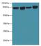 DExD-Box Helicase 50 antibody, LS-C379252, Lifespan Biosciences, Western Blot image 