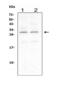 Ciliary Neurotrophic Factor antibody, LS-C313426, Lifespan Biosciences, Western Blot image 