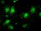 Interleukin Enhancer Binding Factor 2 antibody, MA5-24988, Invitrogen Antibodies, Immunocytochemistry image 