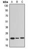 Epididymal Sperm Binding Protein 1 antibody, LS-C668409, Lifespan Biosciences, Western Blot image 