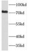 Tudor Domain Containing 3 antibody, FNab08578, FineTest, Western Blot image 