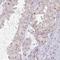 DAZ Interacting Zinc Finger Protein 1 antibody, HPA057272, Atlas Antibodies, Immunohistochemistry frozen image 