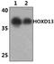 Homeobox D13 antibody, PA5-75937, Invitrogen Antibodies, Western Blot image 