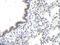 Voltage Dependent Anion Channel 3 antibody, ARP35180_P050, Aviva Systems Biology, Immunohistochemistry paraffin image 
