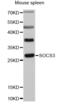 Suppressor Of Cytokine Signaling 3 antibody, STJ25651, St John