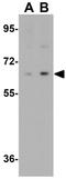 Interferon Regulatory Factor 2 Binding Protein 2 antibody, GTX32054, GeneTex, Western Blot image 