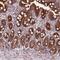 CDGSH Iron Sulfur Domain 3 antibody, PA5-62960, Invitrogen Antibodies, Immunohistochemistry frozen image 