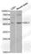 Dyskerin Pseudouridine Synthase 1 antibody, A1862, ABclonal Technology, Western Blot image 