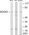 AarF Domain Containing Kinase 5 antibody, EKC1844, Boster Biological Technology, Western Blot image 