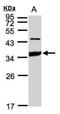 Intercellular Adhesion Molecule 2 antibody, NBP1-31612, Novus Biologicals, Western Blot image 