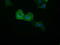 Chromosome 16 Open Reading Frame 72 antibody, LS-C784922, Lifespan Biosciences, Immunofluorescence image 