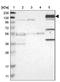 Cilia And Flagella Associated Protein 61 antibody, NBP1-90583, Novus Biologicals, Western Blot image 