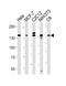 Regulatory Associated Protein Of MTOR Complex 1 antibody, M01463-1, Boster Biological Technology, Western Blot image 
