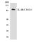 Interleukin 4 Receptor antibody, LS-C292099, Lifespan Biosciences, Western Blot image 