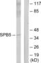 Serpin Family B Member 5 antibody, abx014060, Abbexa, Western Blot image 