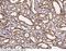 Pyruvate Kinase L/R antibody, 15501-T24, Sino Biological, Immunohistochemistry frozen image 