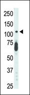 Cyclin Dependent Kinase Like 5 antibody, LS-C100785, Lifespan Biosciences, Western Blot image 