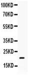 BCL2L2-PABPN1 Readthrough antibody, PA5-78865, Invitrogen Antibodies, Western Blot image 