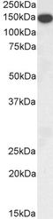 Thrombospondin 1 antibody, LS-B4155, Lifespan Biosciences, Western Blot image 