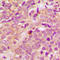 Protein Kinase D1 antibody, LS-C358793, Lifespan Biosciences, Immunohistochemistry frozen image 