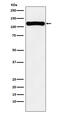 VPS11 Core Subunit Of CORVET And HOPS Complexes antibody, M05575, Boster Biological Technology, Western Blot image 