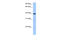 ST6 N-Acetylgalactosaminide Alpha-2,6-Sialyltransferase 4 antibody, 30-508, ProSci, Western Blot image 