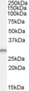 TPD52 Like 2 antibody, MBS420564, MyBioSource, Western Blot image 