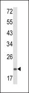 Proteasome Subunit Alpha 7 antibody, LS-C162224, Lifespan Biosciences, Western Blot image 