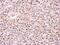 Proteasome 26S Subunit, ATPase 6 antibody, GTX104314, GeneTex, Immunohistochemistry paraffin image 