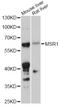Macrophage Scavenger Receptor 1 antibody, LS-C749198, Lifespan Biosciences, Western Blot image 
