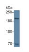 Collagen Type XVII Alpha 1 Chain antibody, LS-C693559, Lifespan Biosciences, Western Blot image 