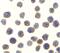 TANK Binding Kinase 1 antibody, PA5-19968, Invitrogen Antibodies, Immunocytochemistry image 