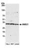 NSE2 (MMS21) Homolog, SMC5-SMC6 Complex SUMO Ligase antibody, A304-126A, Bethyl Labs, Western Blot image 