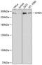 Chromodomain Helicase DNA Binding Protein 4 antibody, 14-052, ProSci, Western Blot image 