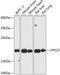 Vacuolar Protein Sorting 25 Homolog antibody, 14-809, ProSci, Western Blot image 
