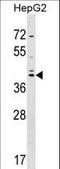 Transcription factor SOX-7 antibody, LS-C159065, Lifespan Biosciences, Western Blot image 