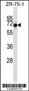 CD5 Molecule antibody, 57-100, ProSci, Western Blot image 