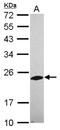 Phosphatase, Orphan 2 antibody, NBP2-19806, Novus Biologicals, Western Blot image 