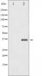 NFKB Inhibitor Beta antibody, abx011061, Abbexa, Western Blot image 