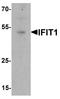 Interferon-induced protein with tetratricopeptide repeats 1 antibody, A02652-1, Boster Biological Technology, Western Blot image 