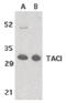 TNF Receptor Superfamily Member 13B antibody, PA5-19972, Invitrogen Antibodies, Western Blot image 