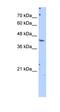 Glutamic-Oxaloacetic Transaminase 1 antibody, orb330539, Biorbyt, Western Blot image 